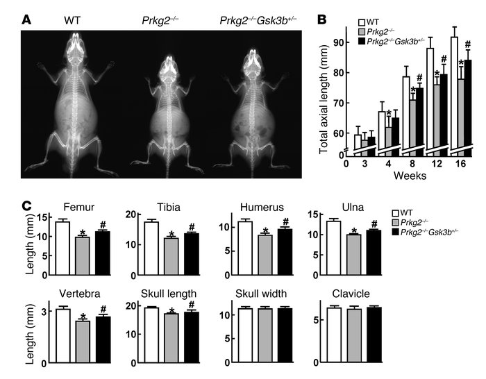 Genetic rescue of growth retardation in Prkg2–/– mice by GSK-3β insuffic...