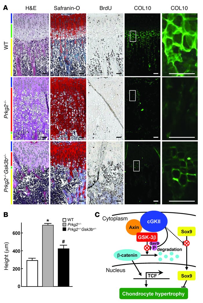Genetic rescue of growth plate abnormality in Prkg2–/– mice by GSK-3β in...