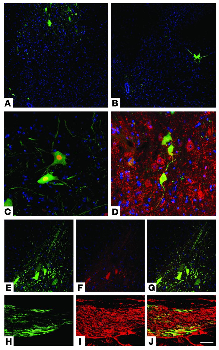 ALDHhiSSClo cells transplanted into SMA mice differentiate into motoneur...