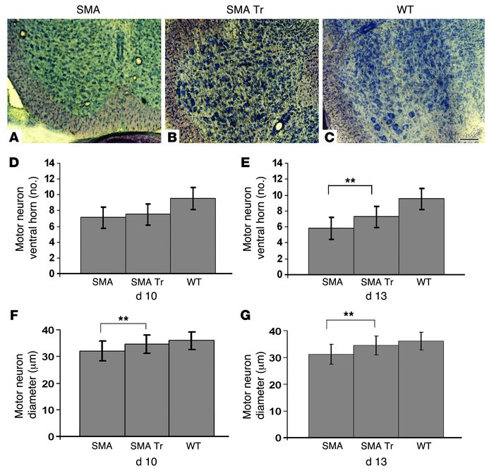 ALDHhiSSClo cell transplantation increases motoneuron size and number.
 ...