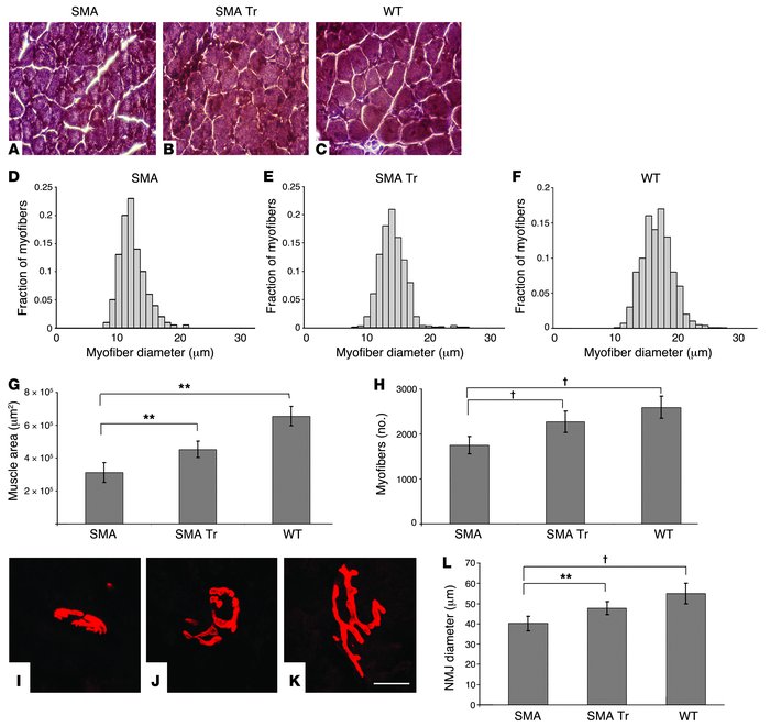 NSC transplantation ameliorates muscle innervation in SMA mice.
SMA mice...