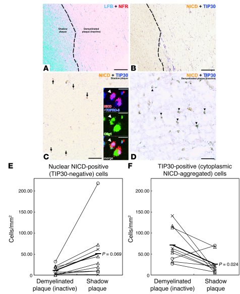 TIP30-positive cells are substantially increased in chronically demyelin...