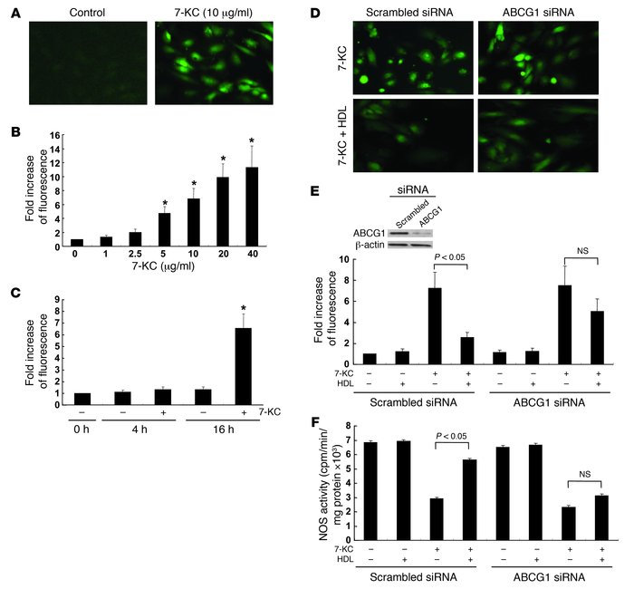 Effects of ABCG1 and HDL in ROS production by 7-KC.
(A and B) HAECs were...