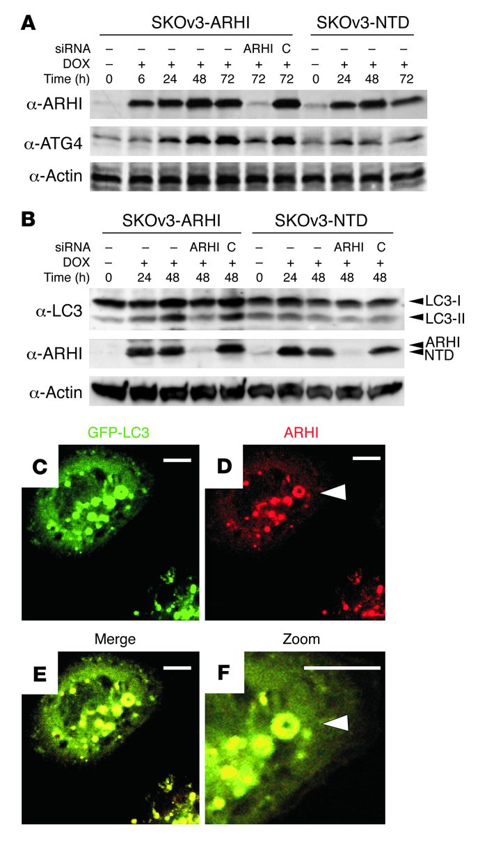 ARHI colocalizes with LC3 in the autophagosome.
(A) ARHI enhances ATG4 e...