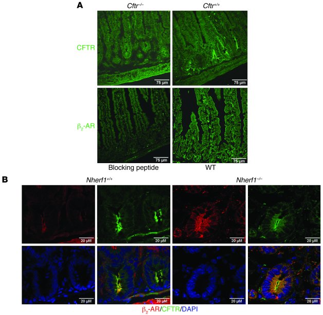 Colocalization of CFTR and β2-AR in the apical membrane of duodenal cryp...