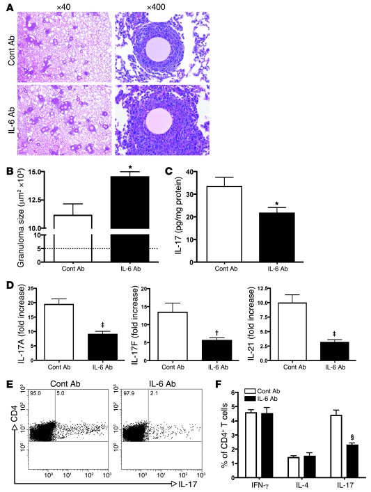 Blockage of IL-6 increases granuloma size and abrogates Th17 phenotype.
...