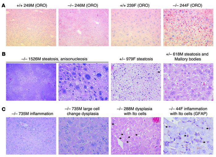 NAFLD and NASH with dysplasia in 10- to 12-week-old Taldo1–/– mice.
   
...