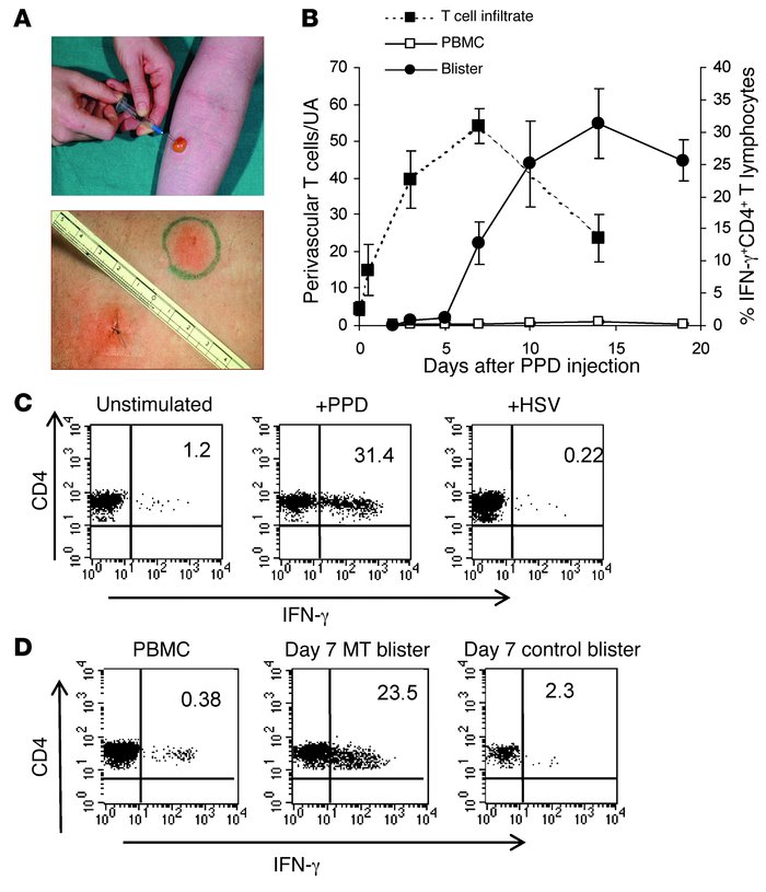 The MT is a well-characterized model of a memory immune response.
Sample...