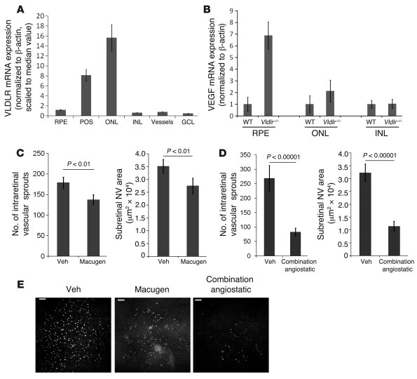 VEGF upregulation is associated with intraretinal NV in Vldlr–/– mice.
 ...