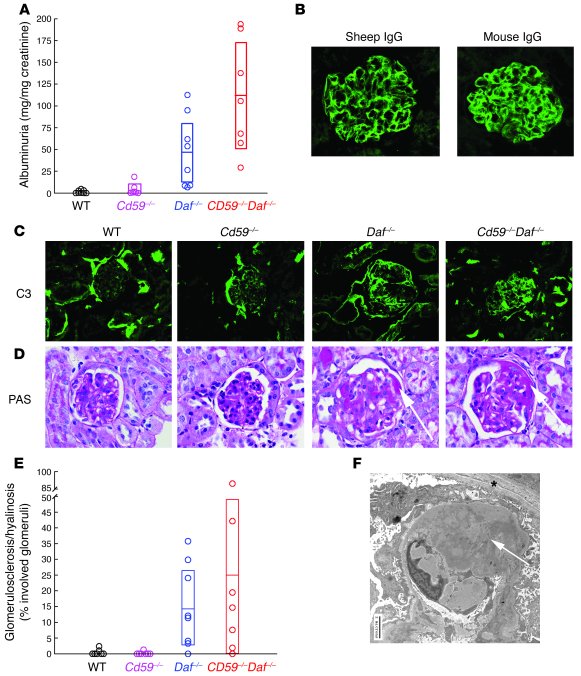 Anti-podo Ab–induced FSGS in DAF-deficient animals.
(A) Significant albu...