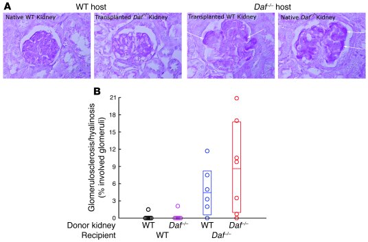 Kidney transplantation studies reveal extrarenal DAF deficiency is neces...