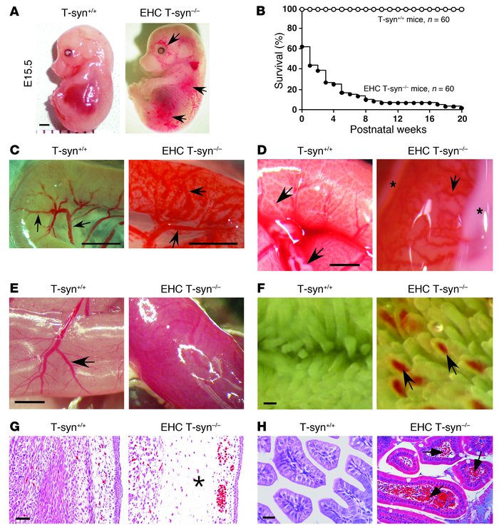 EHC T-syn–/– mice exhibit high embryonic and neonatal mortality, disorga...