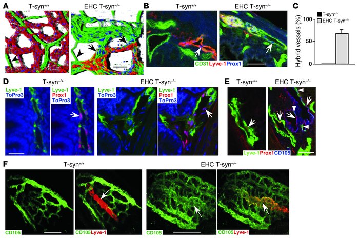 EHC T-syn–/– mice have abnormal connections between blood and lymphatic ...