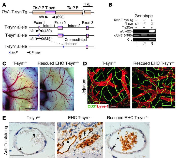 Endothelial expression of C1galt1 rescues EHC T-syn–/– embryonic lethali...