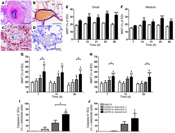 Vascular remodeling and PA EC apoptosis in AdTGF-β1–induced PF.
(A and B...