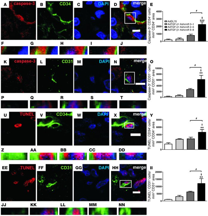 Microvascular EC apoptosis in AdTGF-β1 PF at day 7.
Representative optic...