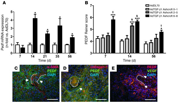 PEDF expression and immunolocalization.
(A) Pedf mRNA in lung homogenate...