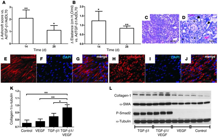 Increased PF following AdTGF-β1/AdVEGF compared with AdTGF-β1/AdDL70 adm...