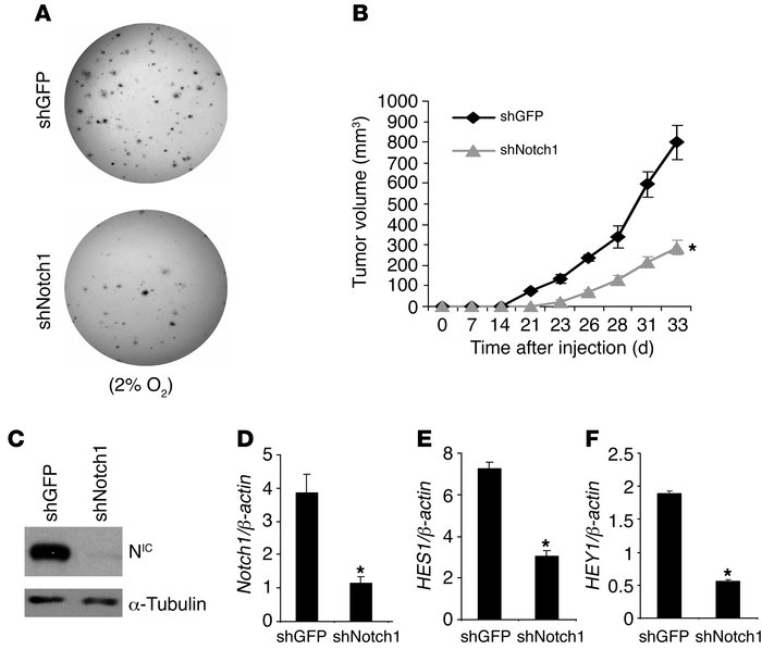 Genetic inhibition of Notch1 reduces melanocyte transformation and tumor...