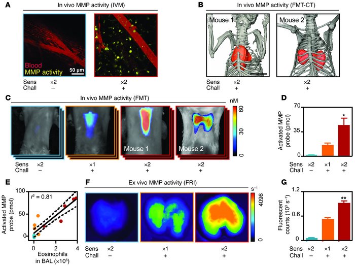 In vivo detection of eosinophil-mediated MMP activity correlates with di...