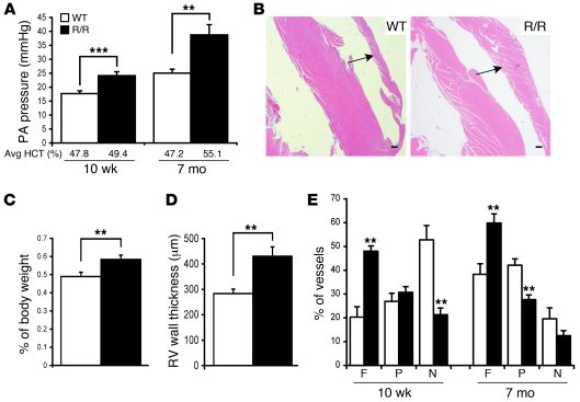 
VhlR/R (R/R) mice develop pulmonary hypertension.
   
(A) Systolic PA p...