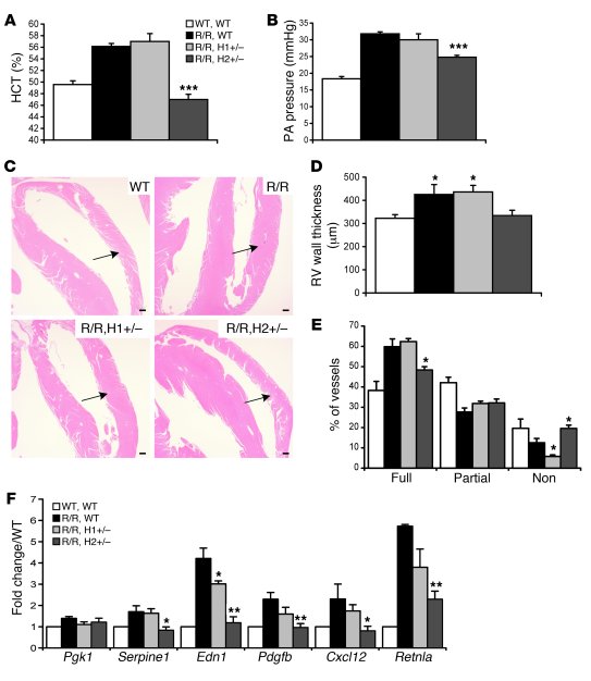 The polycythemic and pulmonary hypertension phenotypes are dependent on ...