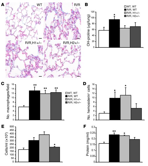 Some, but not all, VhlR/R pulmonary phenotypes, are dependent on HIF-2α ...