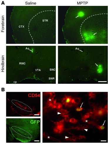 Mechanism of lymphocyte entry into the brain.
(A) Immunofluorescent stai...