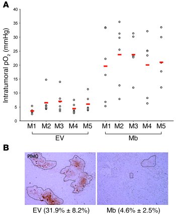 Mb expression promotes tumor oxygenation.
(A) Approximately 5 weeks afte...