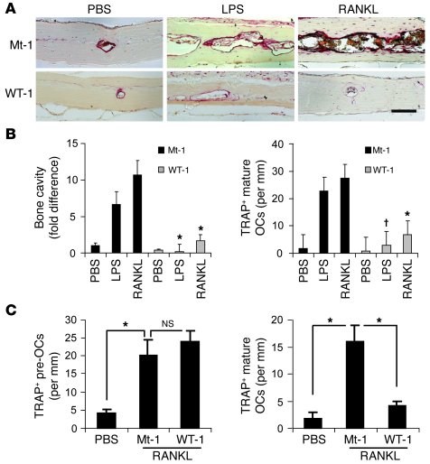 The RRI peptide suppresses LPS- or RANKL-induced OC formation and bone d...