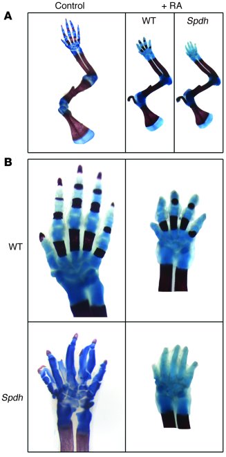 RA treatment rescues the polydactyly phenotype.
(A) Newborn animals were...