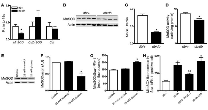 Expression of antioxidant enzymes in bone marrow EPCs.
(A) mRNA levels f...