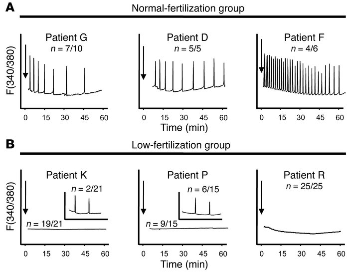Sperm from patients with different ICSI fertilization rates initiate wid...