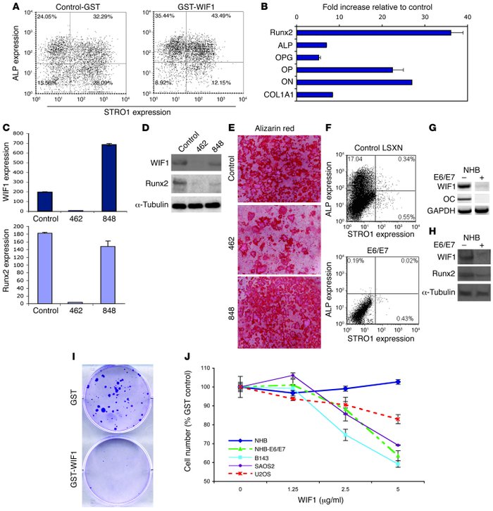 WIF1 regulates osteoblast differentiation and suppresses growth of osteo...