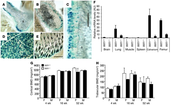 Mice lacking expression of Wif1 undergo normal skeletal development.
(A–...