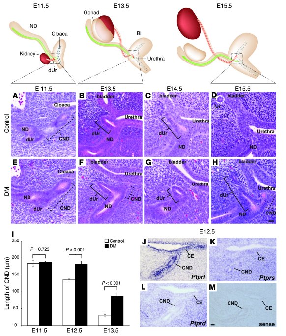 Distal ureter maturation defects in Ptprs–/–PtprfΔP/ΔP embryos.
   
Top:...