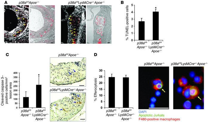 Increased apoptosis in plaques deficient in macrophage p38α MAPK.
(A–C) ...