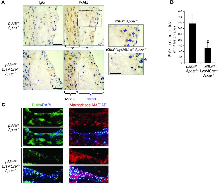 Akt phosphorylation is suppressed by macrophage p38α deficiency in vivo....
