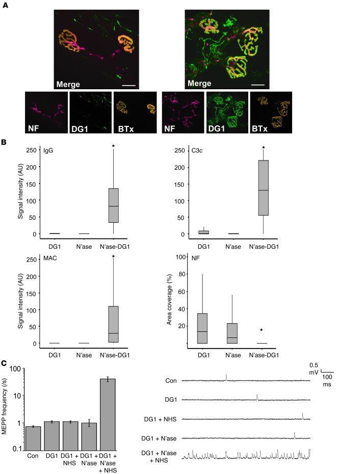 Effect of neuraminidase treatment on anti-GM1 antibody binding and patho...