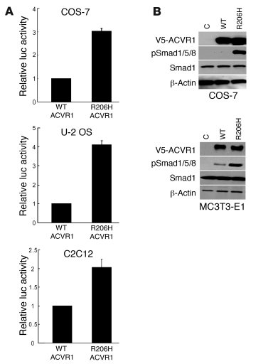 Mutant ACVR1 (c617A; R206H) activates the BMP signaling pathway.
(A) Act...