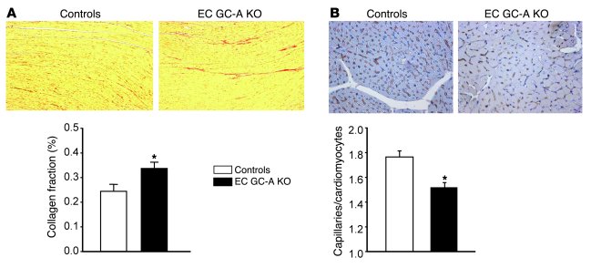 Cardiac vascular rarefaction and fibrosis in EC GC-A KO mice subjected t...