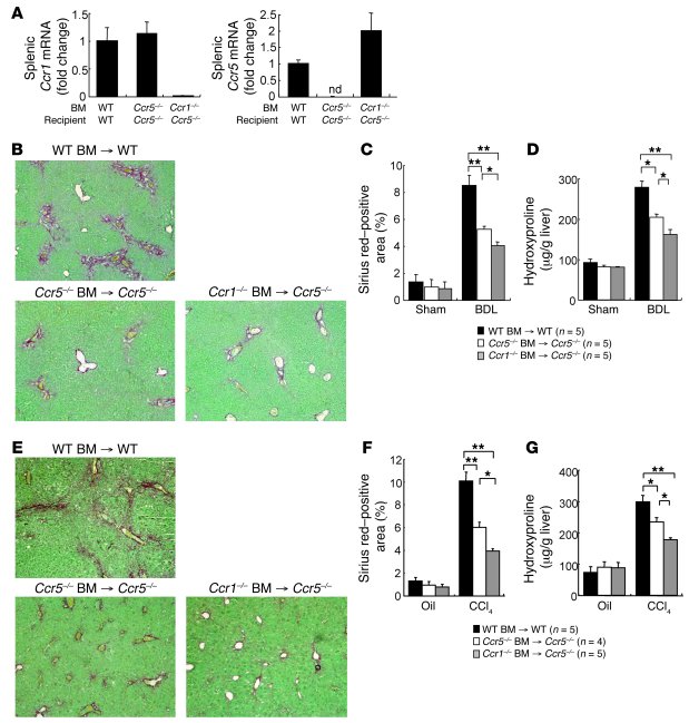 CCR1-deficient BM reduces fibrosis in CCR5-deficient mice.
BMT was perfo...