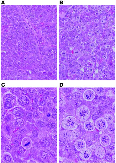 PLK1424-2A induces distinct phenotypic changes typical of PLK1 inhibitio...