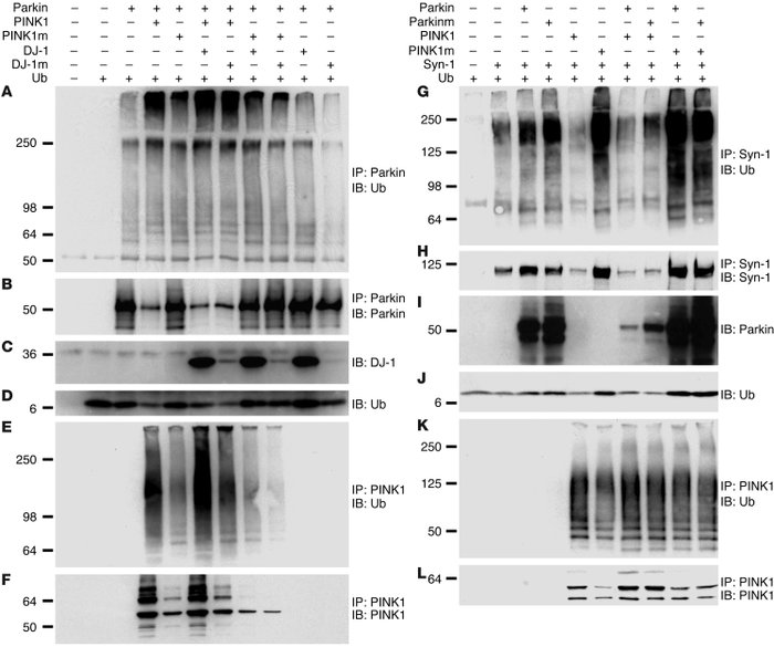 PINK1 regulates ubiquitination of Parkin and Synphilin-1.
Parkin (left) ...