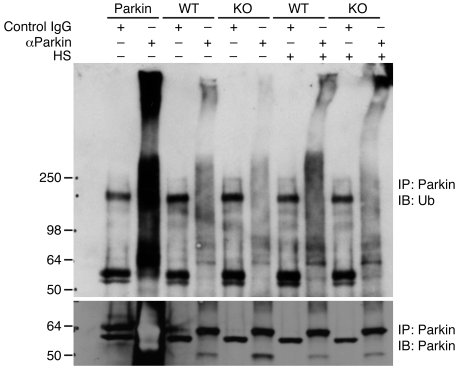 Ubiquitination of endogenous Parkin in mouse brains with PINK1 and DJ-1 ...