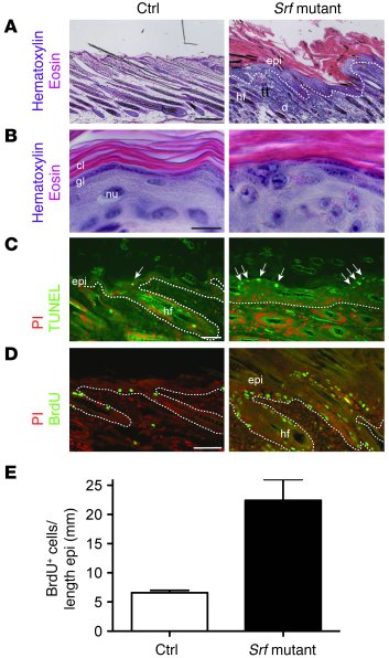 Loss of SRF expression in keratinocytes leads to hyperproliferative epid...