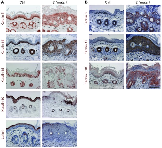 Keratinocyte differentiation is impaired in Srf mutant epidermis.
   
(A...