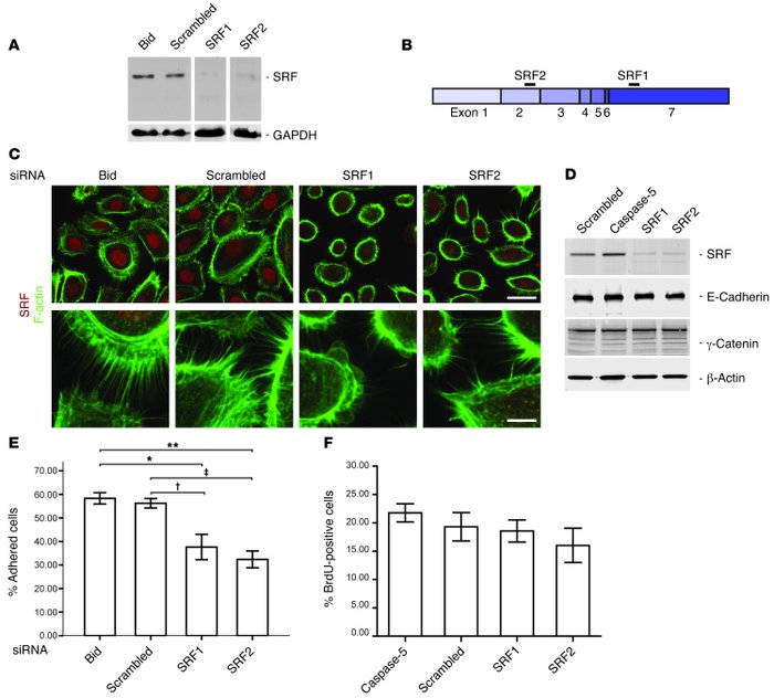 siRNA-mediated downregulation of SRF in primary human keratinocytes disr...