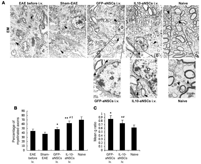 Transplanted aNSCs promote remyelination of demyelinated axons in spinal...