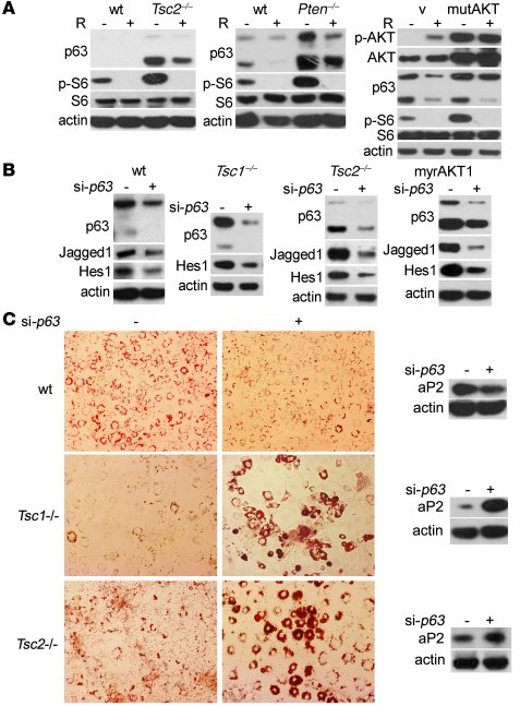 mTOR activates the Notch pathway through upregulation of p63.
(A) WT, Ts...